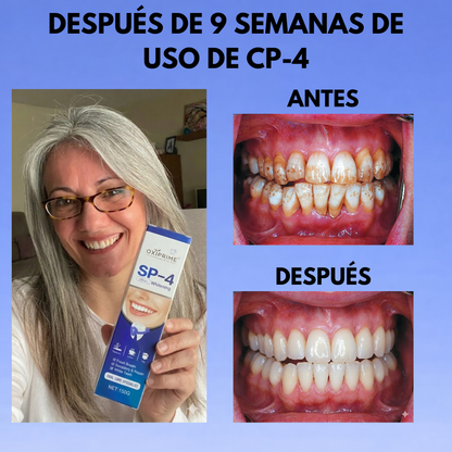 Sistema Dental Avanzado SP-4™ Volvé a sonreír sin vergüenza desde el primer uso