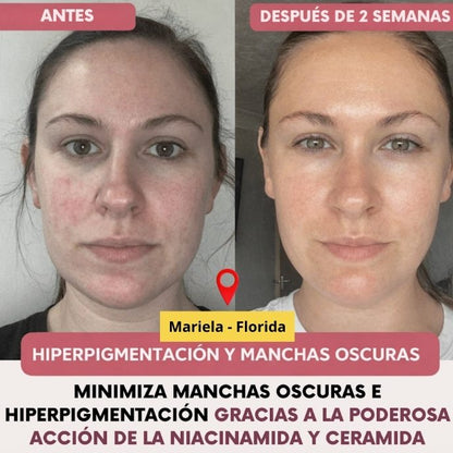 Collagen Pro™ – Máscara Facial de Colágeno Avanzado