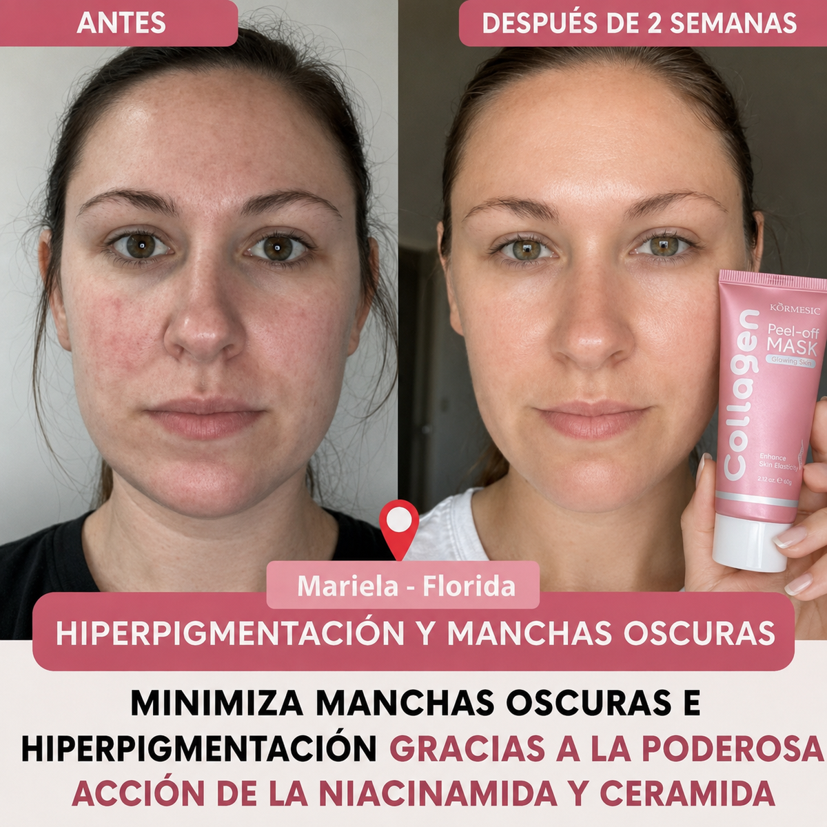 Collagen Pro™ – Máscara Facial de Colágeno Avanzado