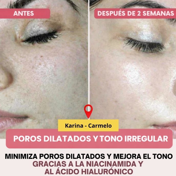 Collagen Pro™ – Máscara Facial de Colágeno Avanzado