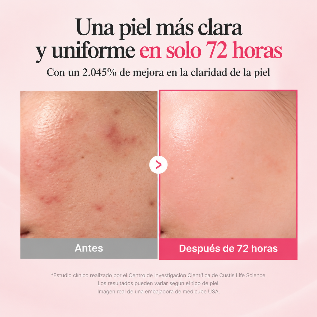 Sérum medicube - Ácido Tranexámico + Niacinamida - 30ml.