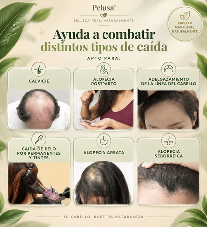 Organic Repair™ Shampoo para la caída severa de cabello. 500ml.