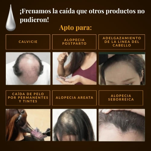 Organic Repair™ Shampoo para la caída severa de cabello.