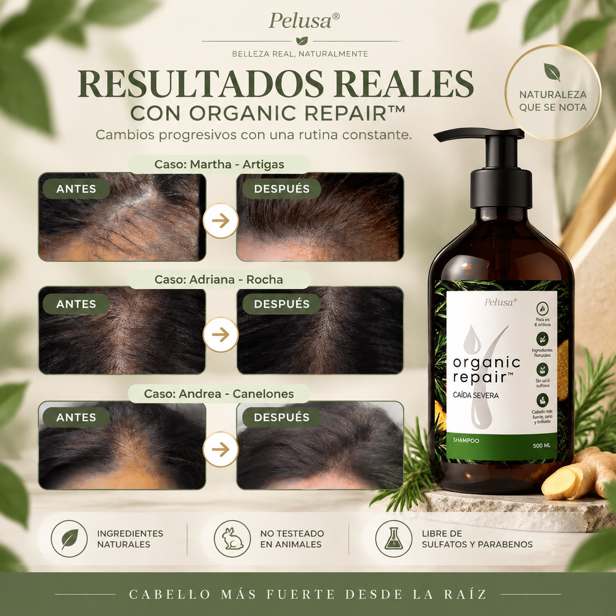 Organic Repair™ Shampoo para la caída severa de cabello. 500ml.