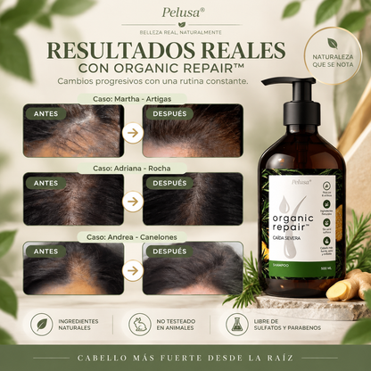 Organic Repair™ Shampoo para la caída severa de cabello. 500ml.