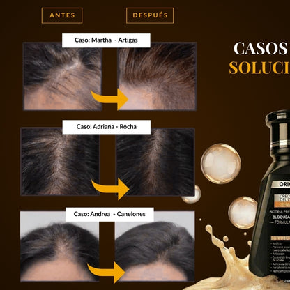 Organic Repair™ Shampoo para la caída severa de cabello.