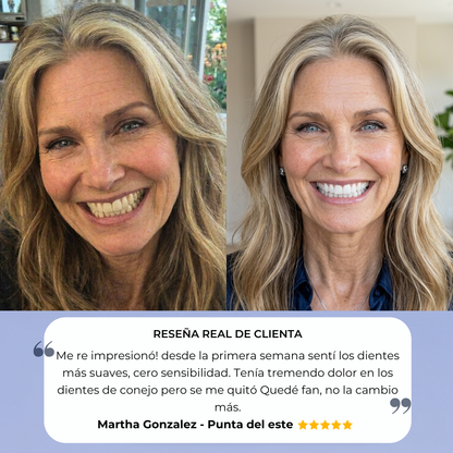 Sistema Dental Avanzado SP-4™ Volvé a sonreír sin vergüenza desde el primer uso