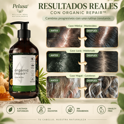Organic Repair™ Shampoo para la caída severa de cabello. 500ml.