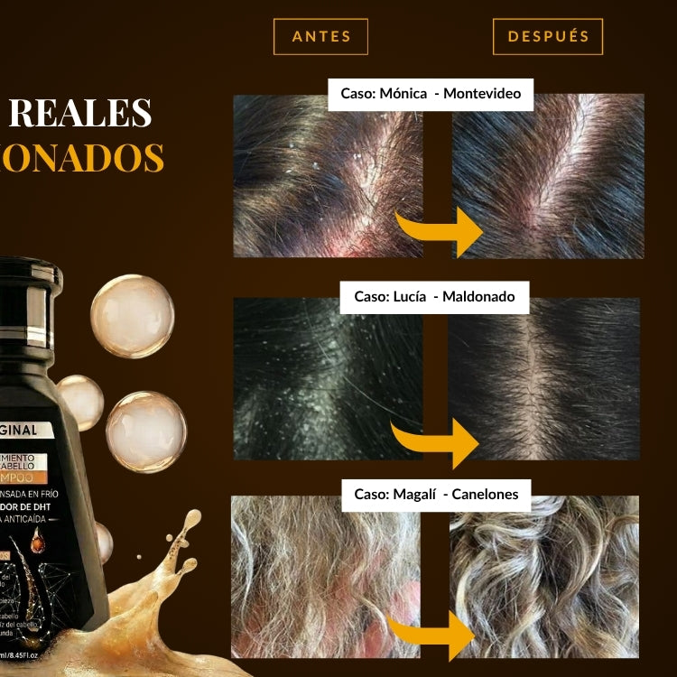 Organic Repair™ Shampoo para la caída severa de cabello.