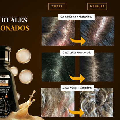 Organic Repair™ Shampoo para la caída severa de cabello.