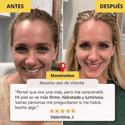 Collagen Pro™ – Máscara Facial de Colágeno Avanzado