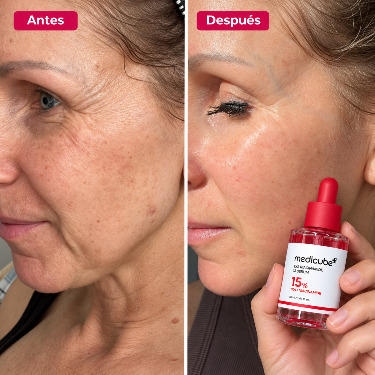 Sérum medicube - Ácido Tranexámico + Niacinamida - 30ml.