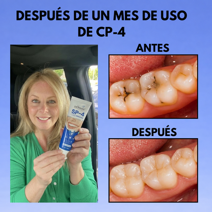 Sistema Dental Avanzado SP-4™ Volvé a sonreír sin vergüenza desde el primer uso