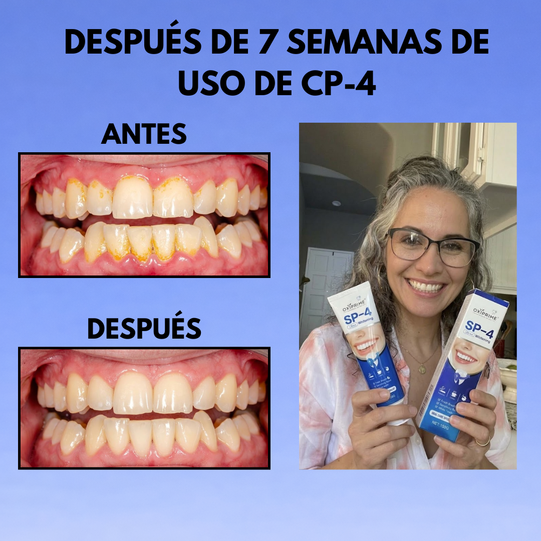 Sistema Dental Avanzado SP-4™ Volvé a sonreír sin vergüenza desde el primer uso