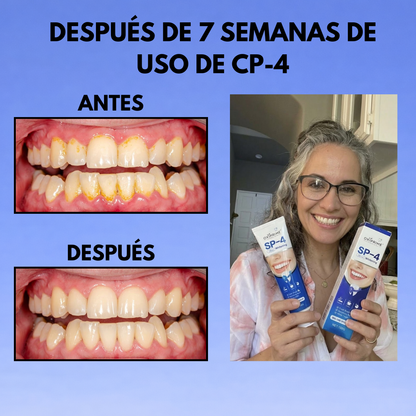 Sistema Dental Avanzado SP-4™ Volvé a sonreír sin vergüenza desde el primer uso