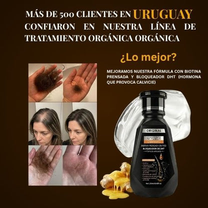 Organic Repair™ Shampoo para la caída severa de cabello.