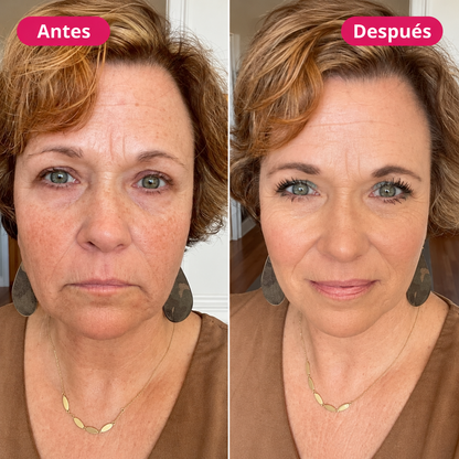 Sérum medicube - Ácido Tranexámico + Niacinamida - 30ml.