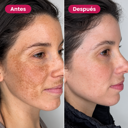 Sérum medicube - Ácido Tranexámico + Niacinamida - 30ml.